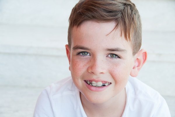 Get Ahead Of Your Orthodontic Care With Braces For Kids