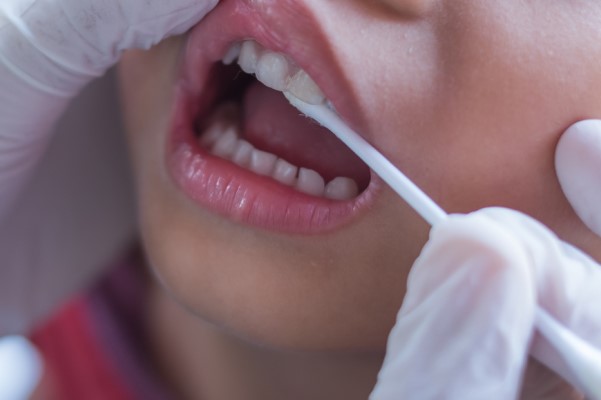 A Guide To Children And Fluoride Use From A Pediatric Dentist