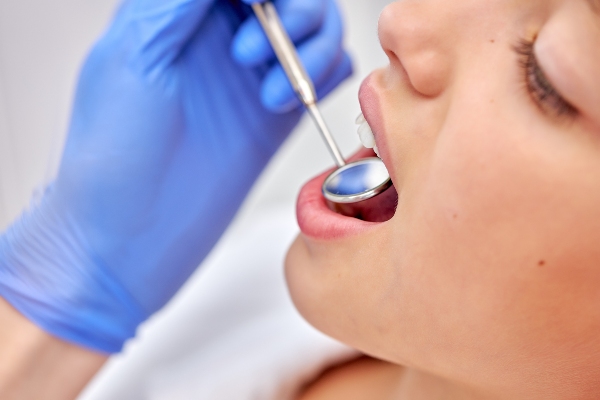 Is Dental Sealant Treatment Painless?