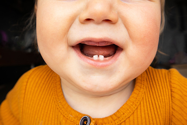 A Kid Friendly Dentist Shares Tips For Teething Babies