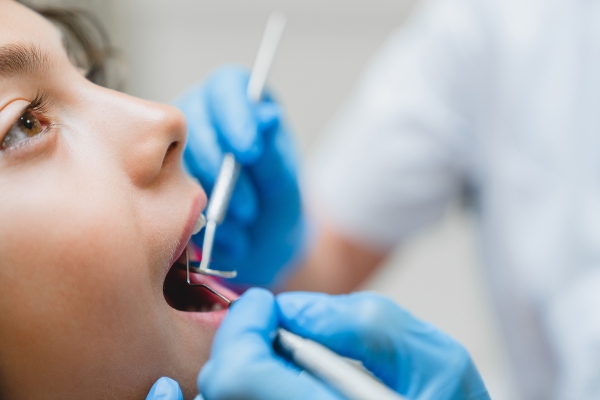Kids Dental Crowns Vs  Dental Veneers: Finding What Your Child Needs