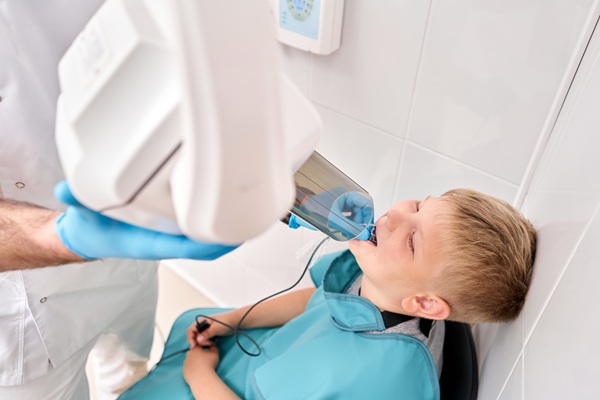 Pediatric Dental X Rays: Common Questions Answered