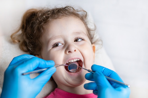 A Pediatric Dentist Talks About The Importance Of Cavity Prevention